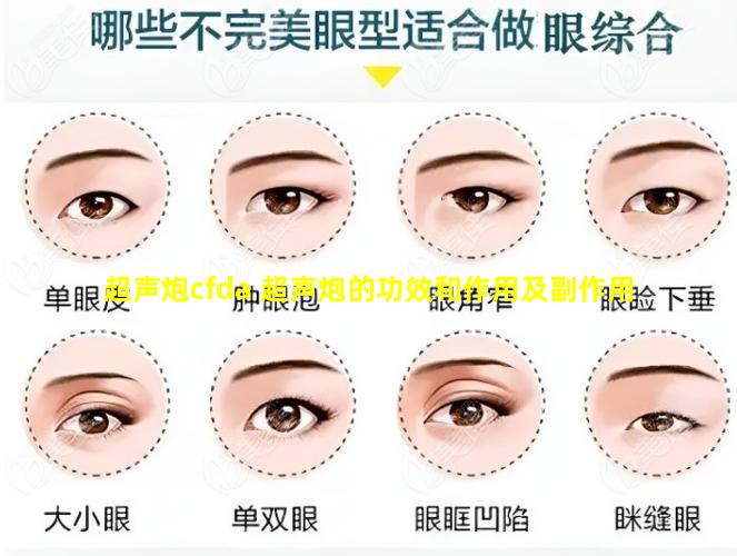 超声炮cfda 超声炮的功效和作用及副作用